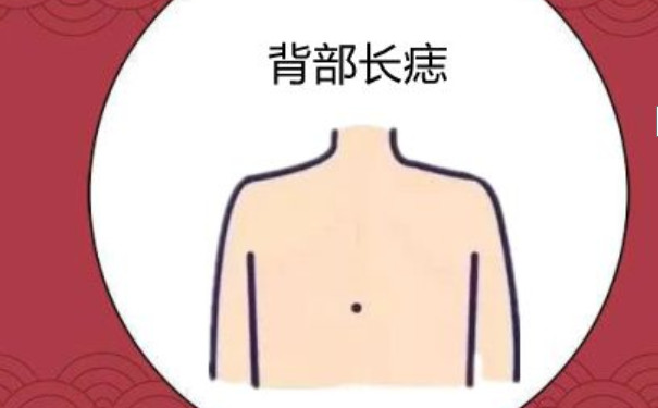后背有痣的喻意是什么 原来竟然还隐藏着这么重要的信息