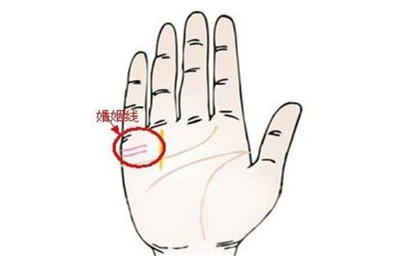 婚姻线下垂