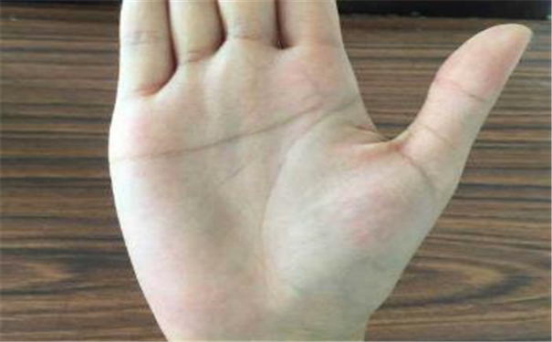 两只手都是断掌的男人