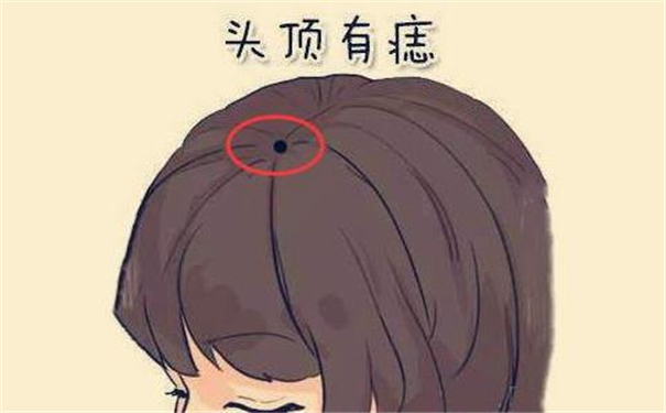 头顶上有痣