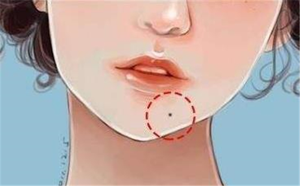 下巴左边有痣