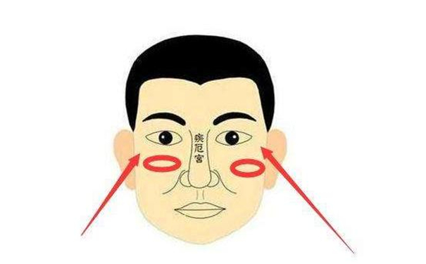 �����־��񲡵����࣬�������֮��