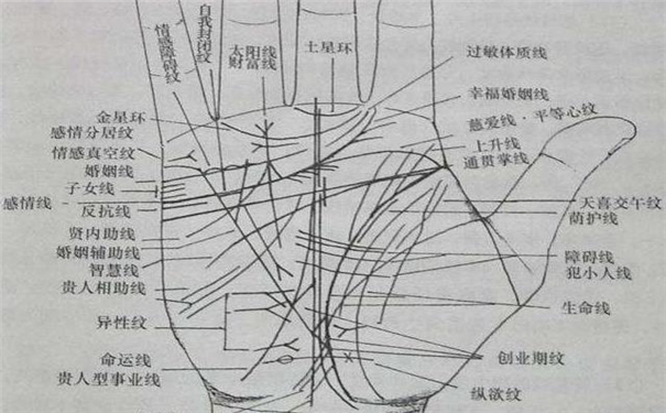 精神病的手相
