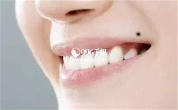 好吃痣