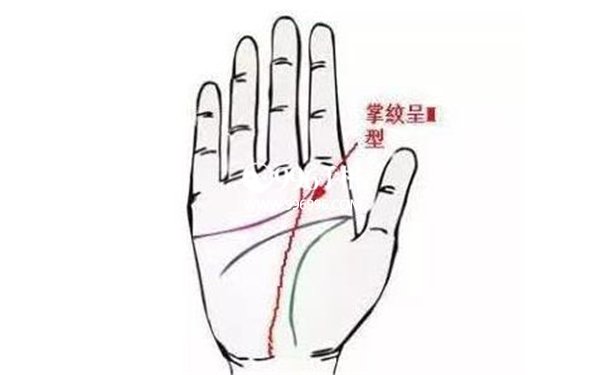 什么是m纹