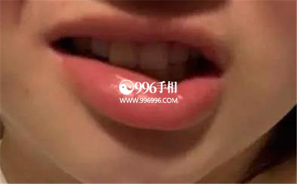 嘴巴歪斜