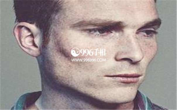 面相颧骨高