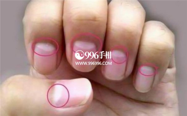 怀孕的手相