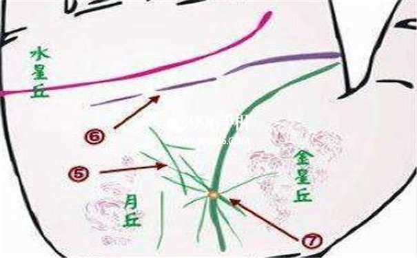 早期胃癌手指和手掌图