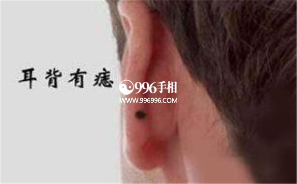 痣相的好坏
