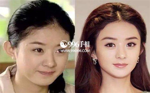 发际线看面相