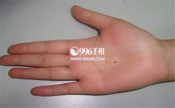 手心痣不同位置的图解