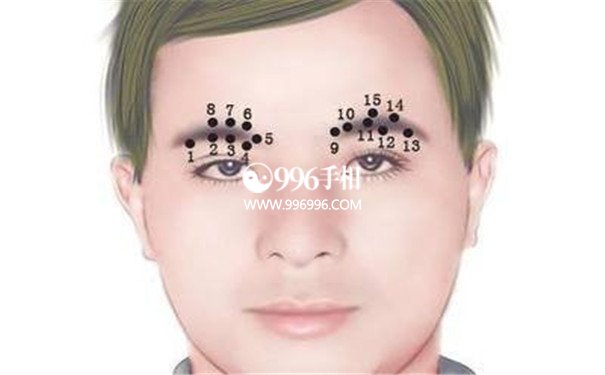 痣的面相术
