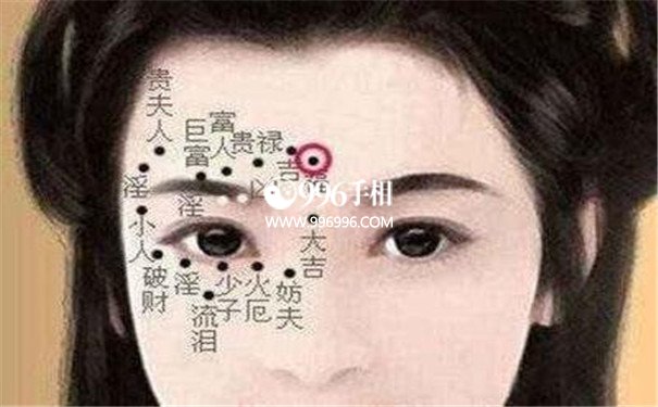 必须取的痣