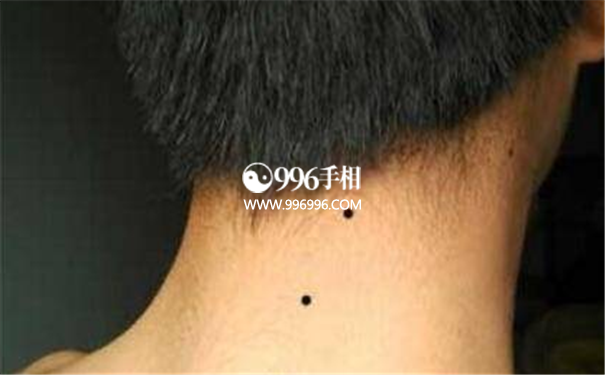 男人全身长痣情况图解