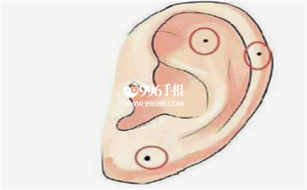 女人耳朵上长痣