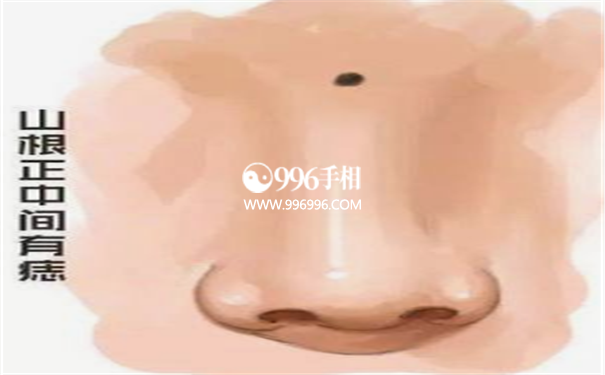 男人鼻子上有痣