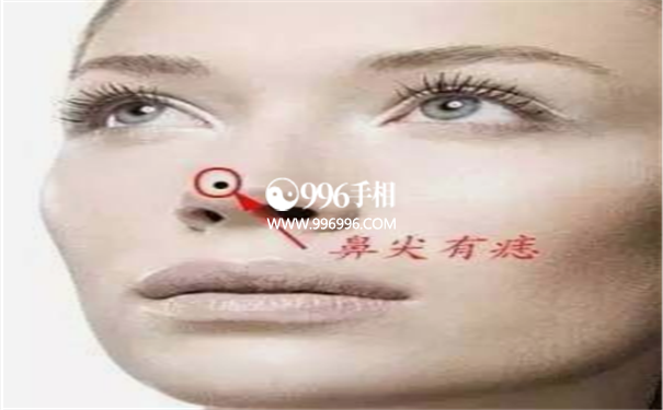 面相爱情痣