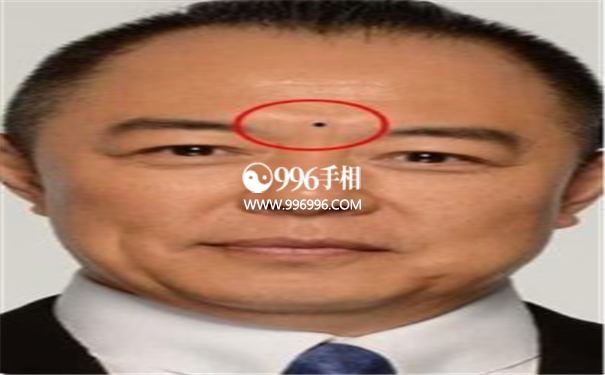 防夫痣特征