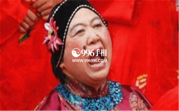 媒婆痣解析