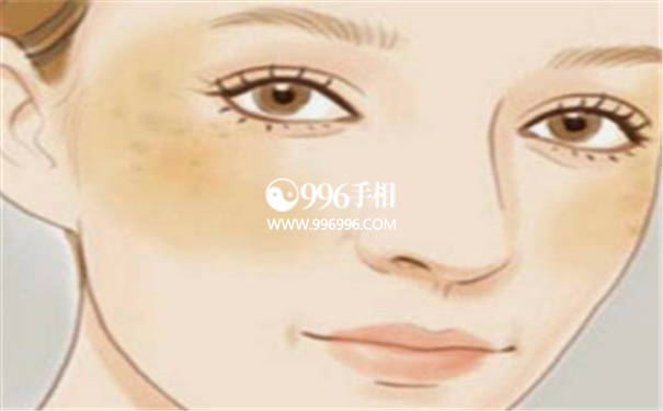 青痣是好痣吗