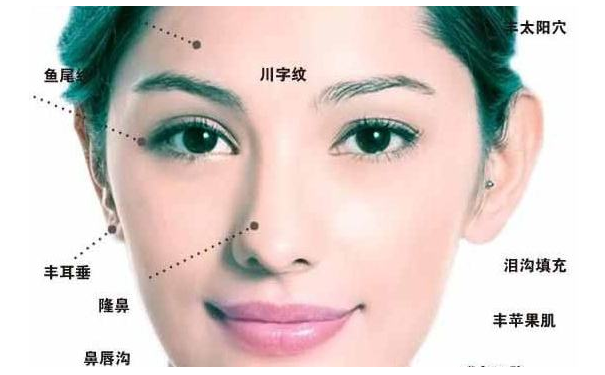 ��ͷ�����࣬��ͷ��û��ǲ����أ�