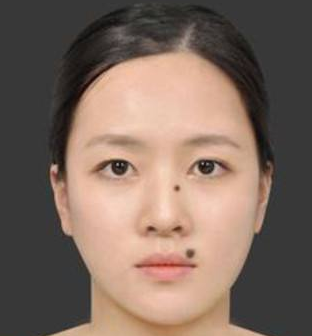 ����ǰӦ��ע��Щʲô