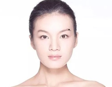 痣点掉