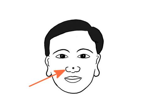 男人脸痣图解