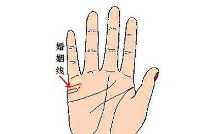 婚姻线下垂