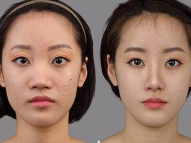 鼻头大面相分析