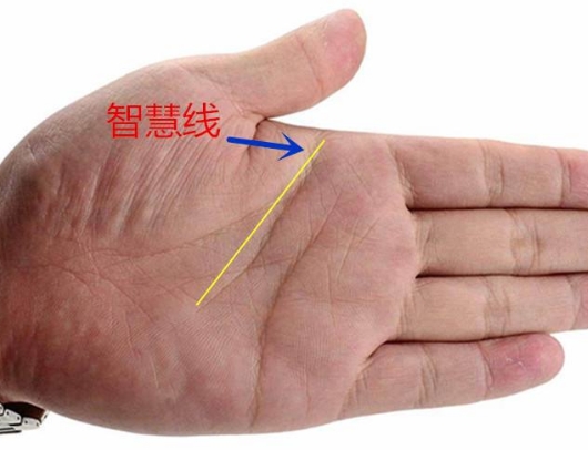 智慧线断开