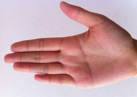 ôͼ