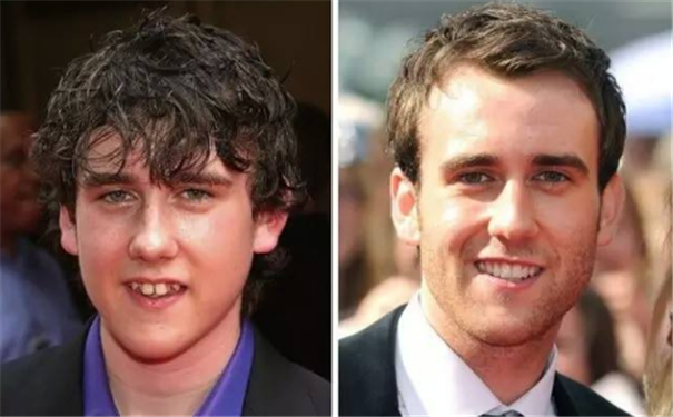 �������ݲ���֮���Ը����Ʒ���