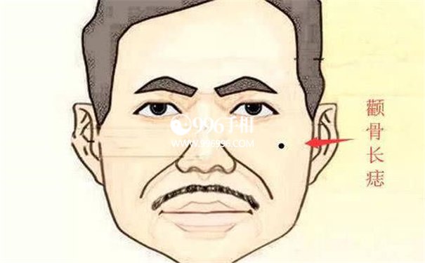 相学痣相