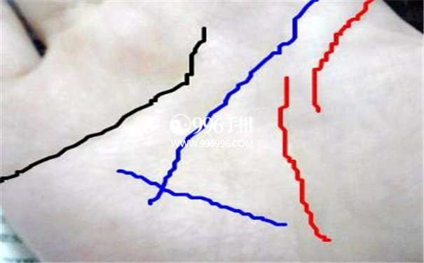 岛纹不详