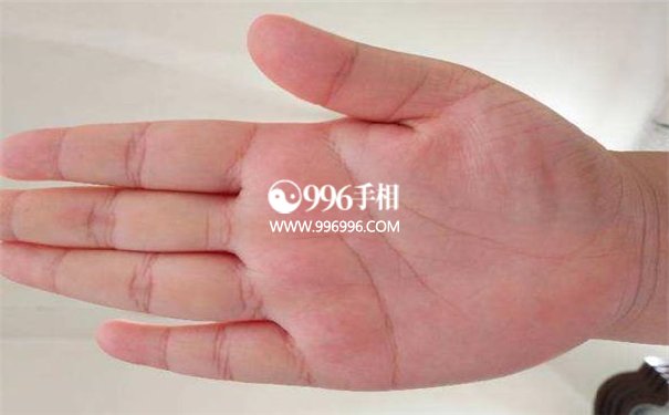 没有事业线