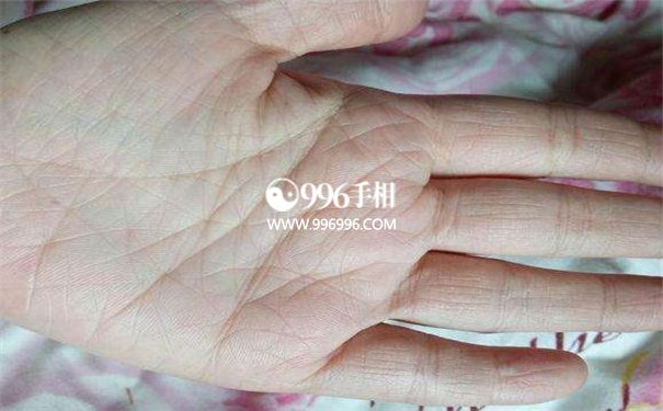 掌纹诊断医学生命线断