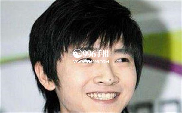 男人面部痣相最准图