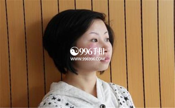 胎记的位置与命运