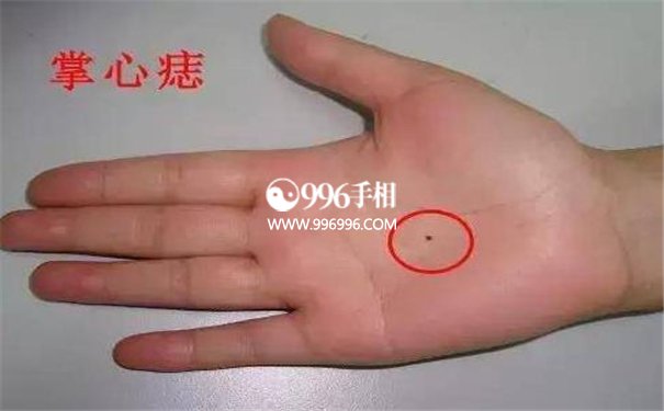 手心的痣相