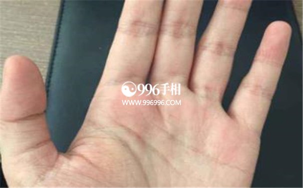 小指很短