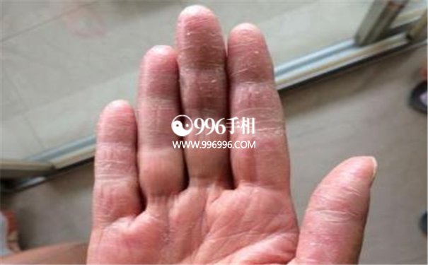 中指很长