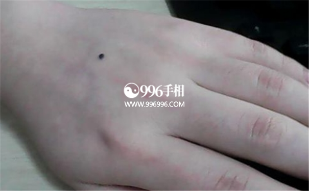 手背痣相