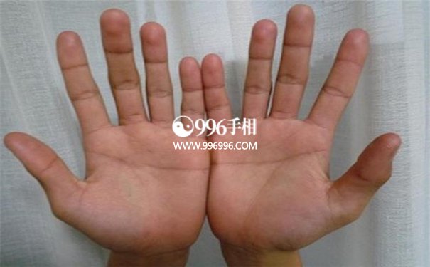 什么是婚姻线呢