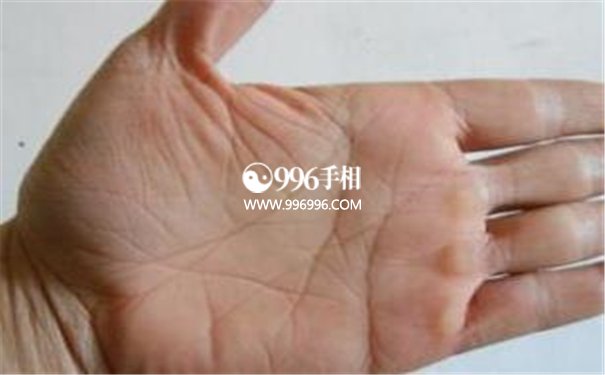 成功线种类