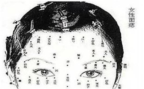 罕见痣相