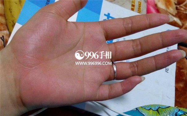 手色泽看健康