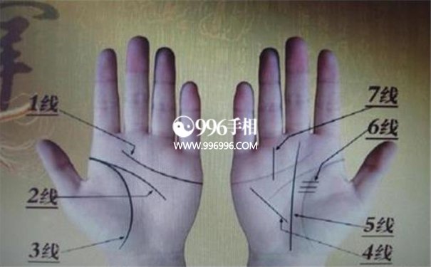 糖尿病手掌纹的看法