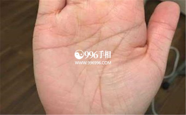 不健康的手相